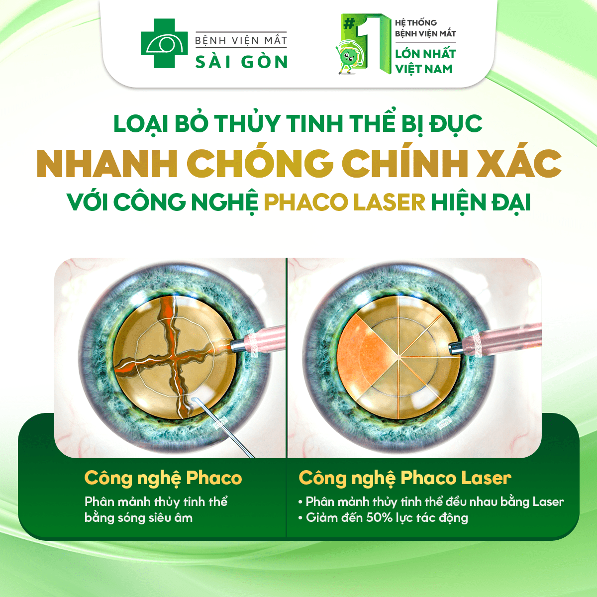 Giải Pháp Điều Trị Đục Thủy Tinh Thể Bằng Femto Cataract: Tiên Phong Trong Công Nghệ Mắt Hiện Đại 